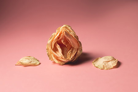 Durchführung einer Biopsie der Vulva in der Praxis von Sexualmedizinerin und Gynäkologin Dr.in Andrea Kottmel Sinnbild Biopsie